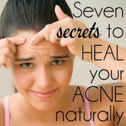 7 secrets to heal your acne naturally